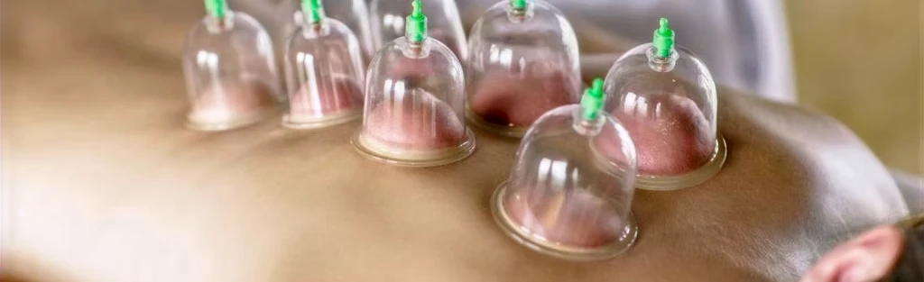 Procedimento de coleta de sangue utilizando seringas em ambiente clínico, representando procedimentos médicos e cuidados de saúde.